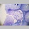 Neuronas Nissl 02.jpg